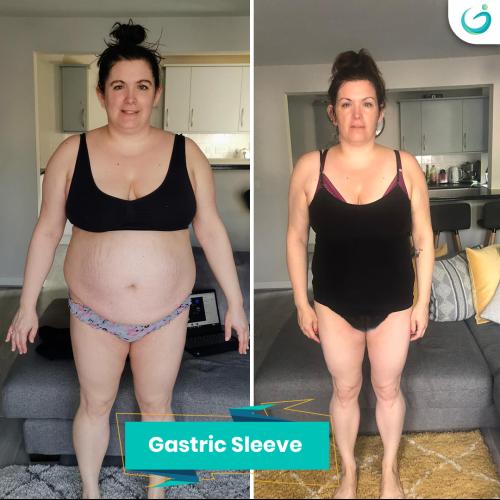 Before after photos of our patients 9